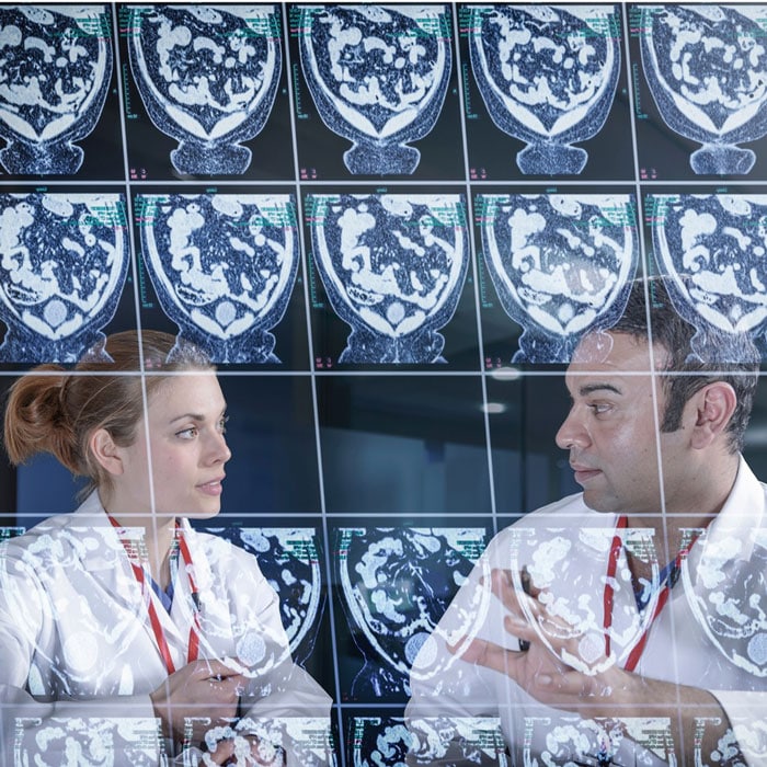 doctors looking at brain scan images